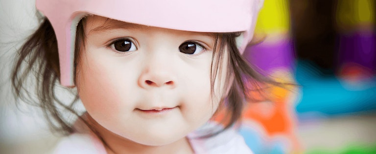 De La Torre baby helmet